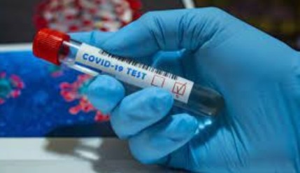 497 са новите случаи на коронавирус у нас Това е